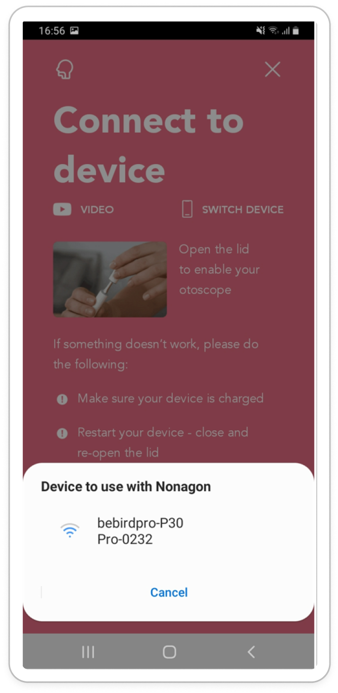 Otoscope Beta Version Guide NONAGON